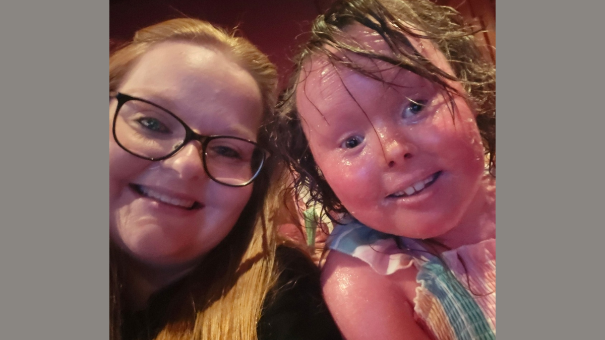 Poppy, who has harlequin ichthyosis, takes a selfie with her mum, Amy. Poppy has red skin and dark hair and a cheeky grin. Amy has blonde hair and wears glasses.
