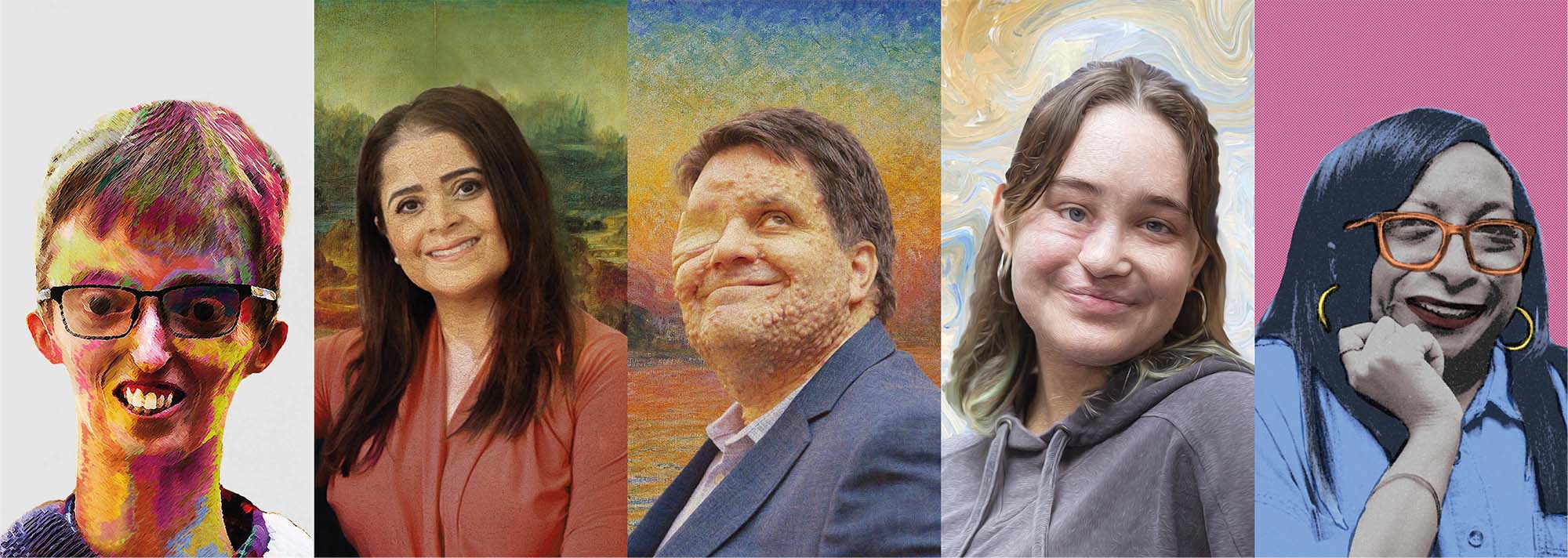Five portrait images for Face Equality Wee., Each one is a Changing Faces campaigners in the style of a famous artist.
