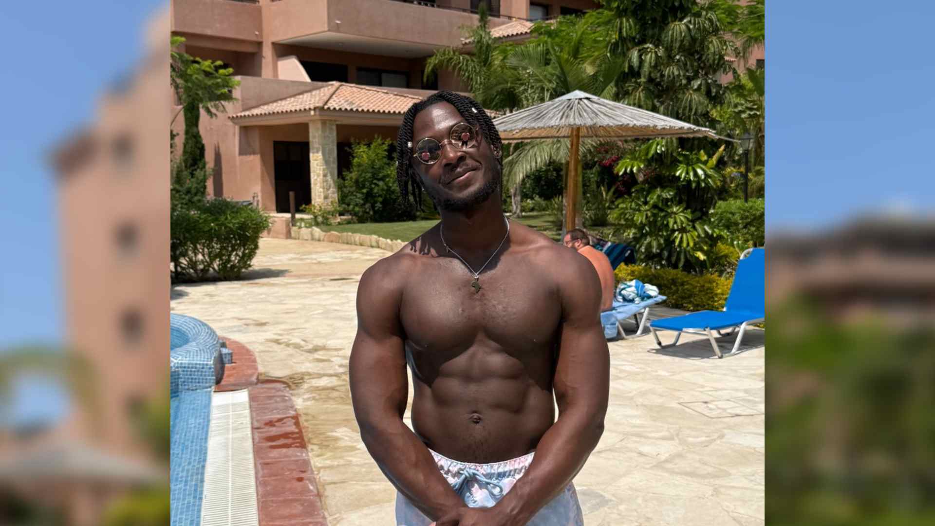 Romeo is a black man with burns scarring on his chest and neck. He stands beside a pool wearing swim shorts and sunglasses, accepting his body as a man with scars.