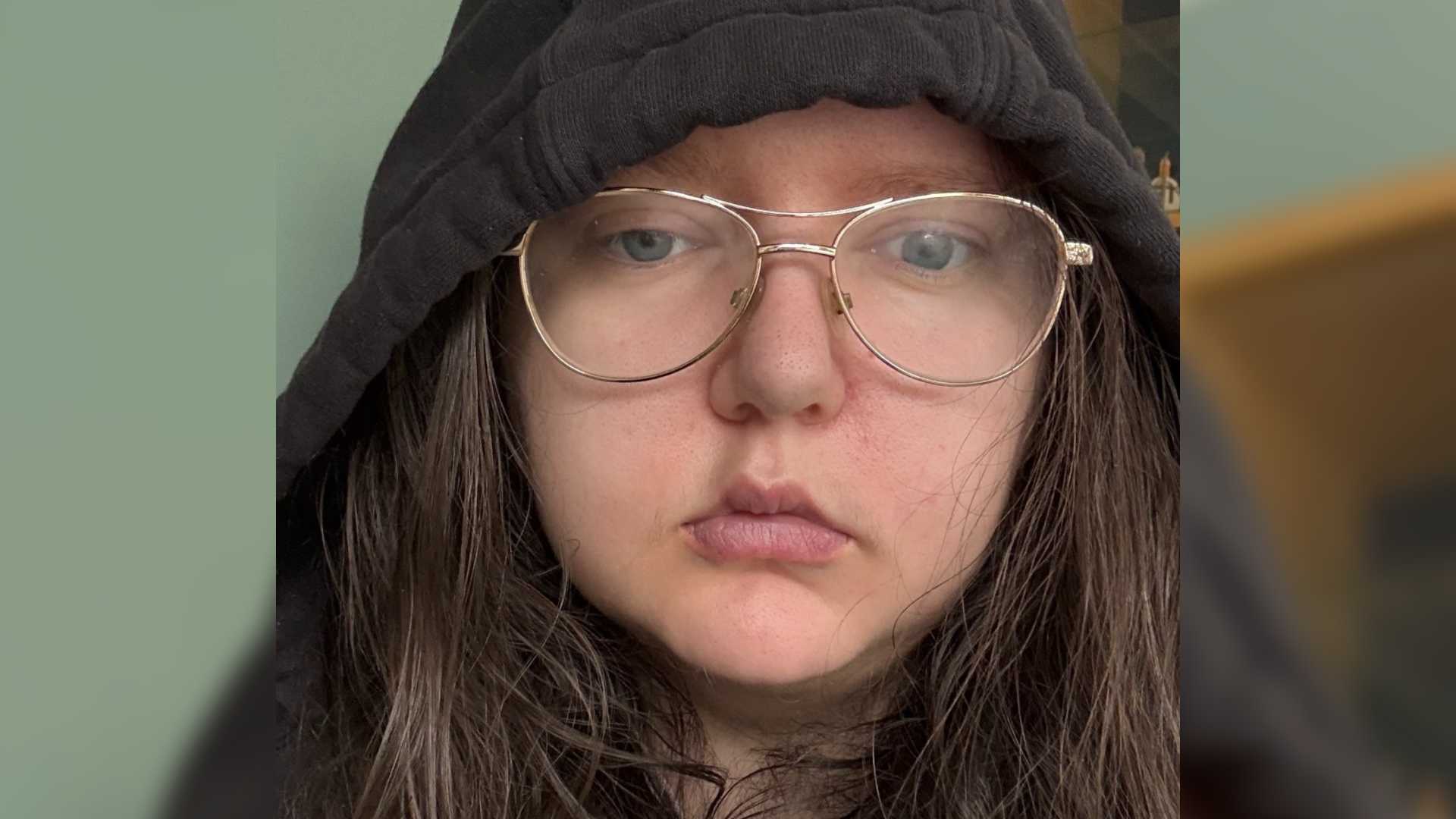 Beth has facial palsy. She takes a selfie of herself wearing large silver rimmed glasses and a black hoodie.