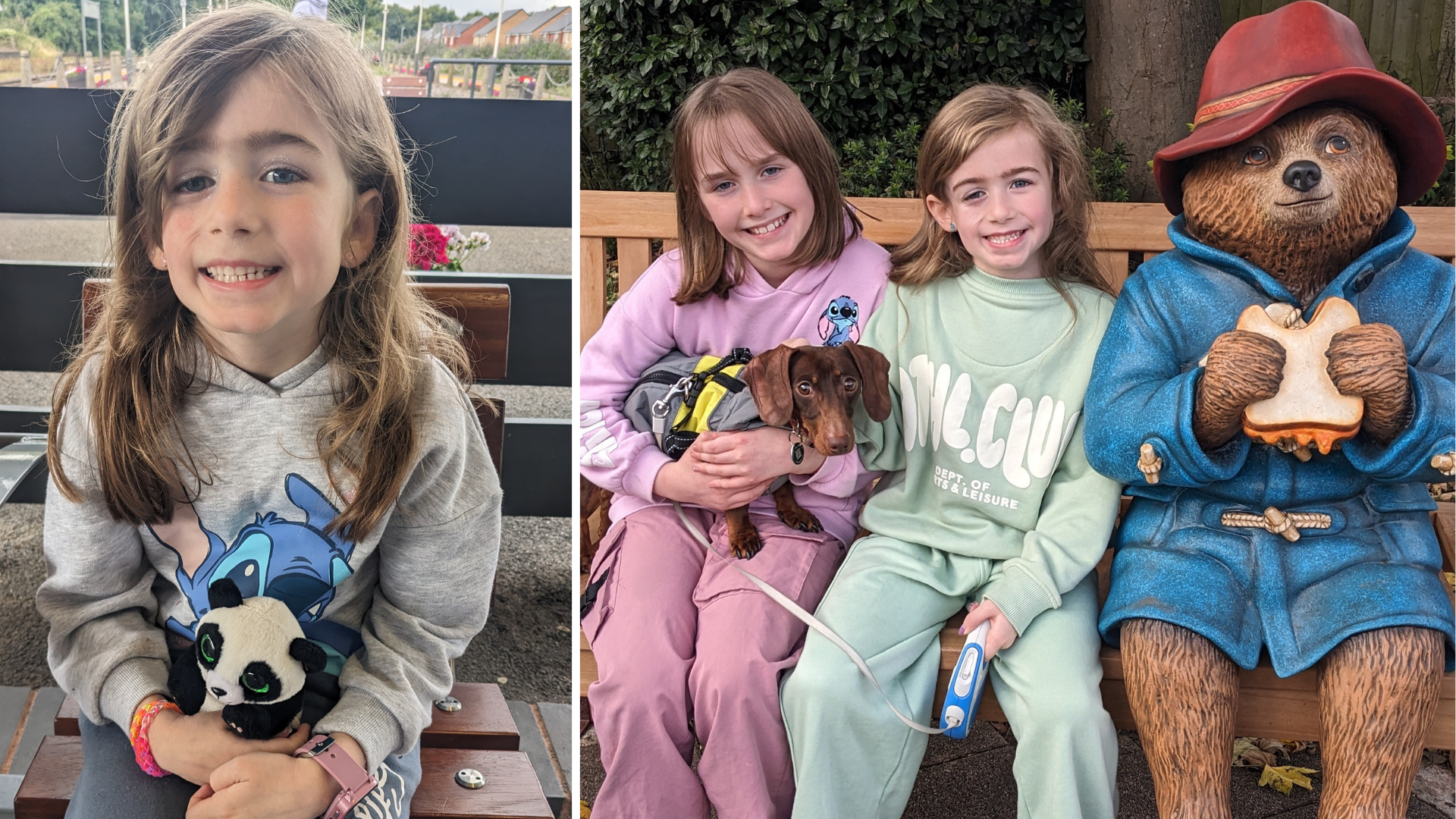 Anna, Saoirse's child who has Parry-Romberg syndrome