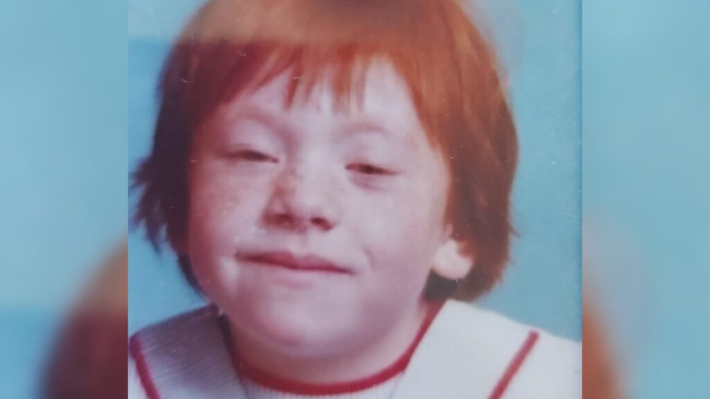 A photo of Gemma as a child before she had surgery to improve her ptosis.