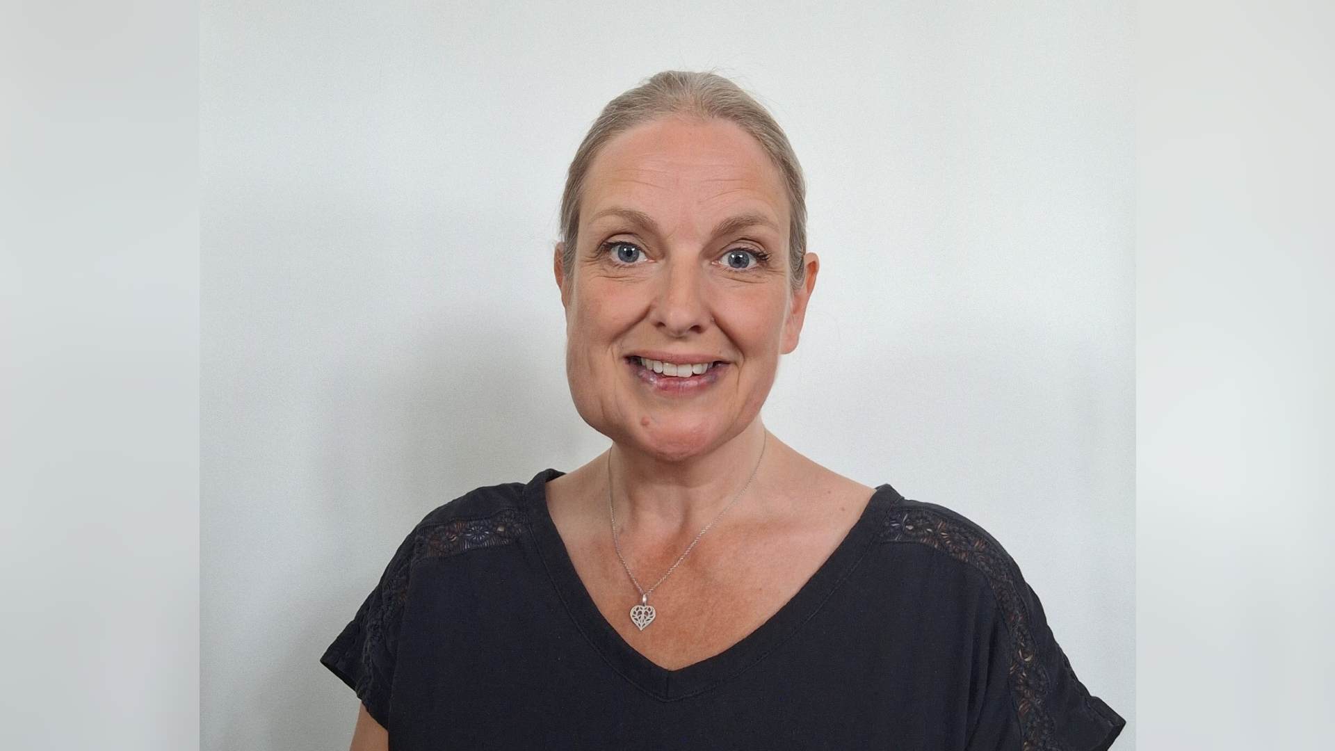 Jo has a birthmark on her lip and vascular anomaly on her cheek. She has her blond hair pulled back into a ponytail and wears a black t-shirt.