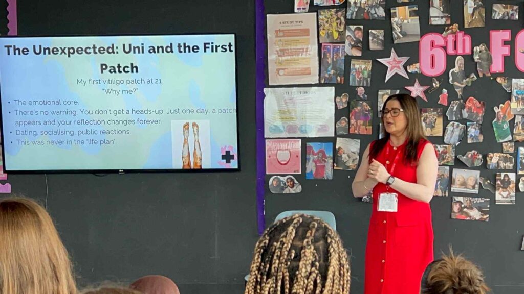 Joti teaching secondary school students about visible differences. She stands at the front of a classroom with a presentation about her vitiligo next to her.
