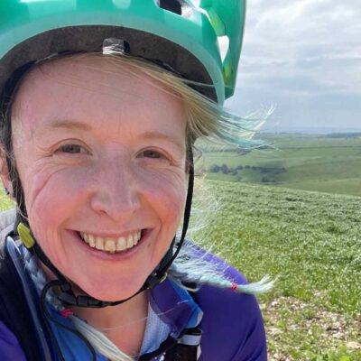 The challenge of selfie culture when you have a visible difference