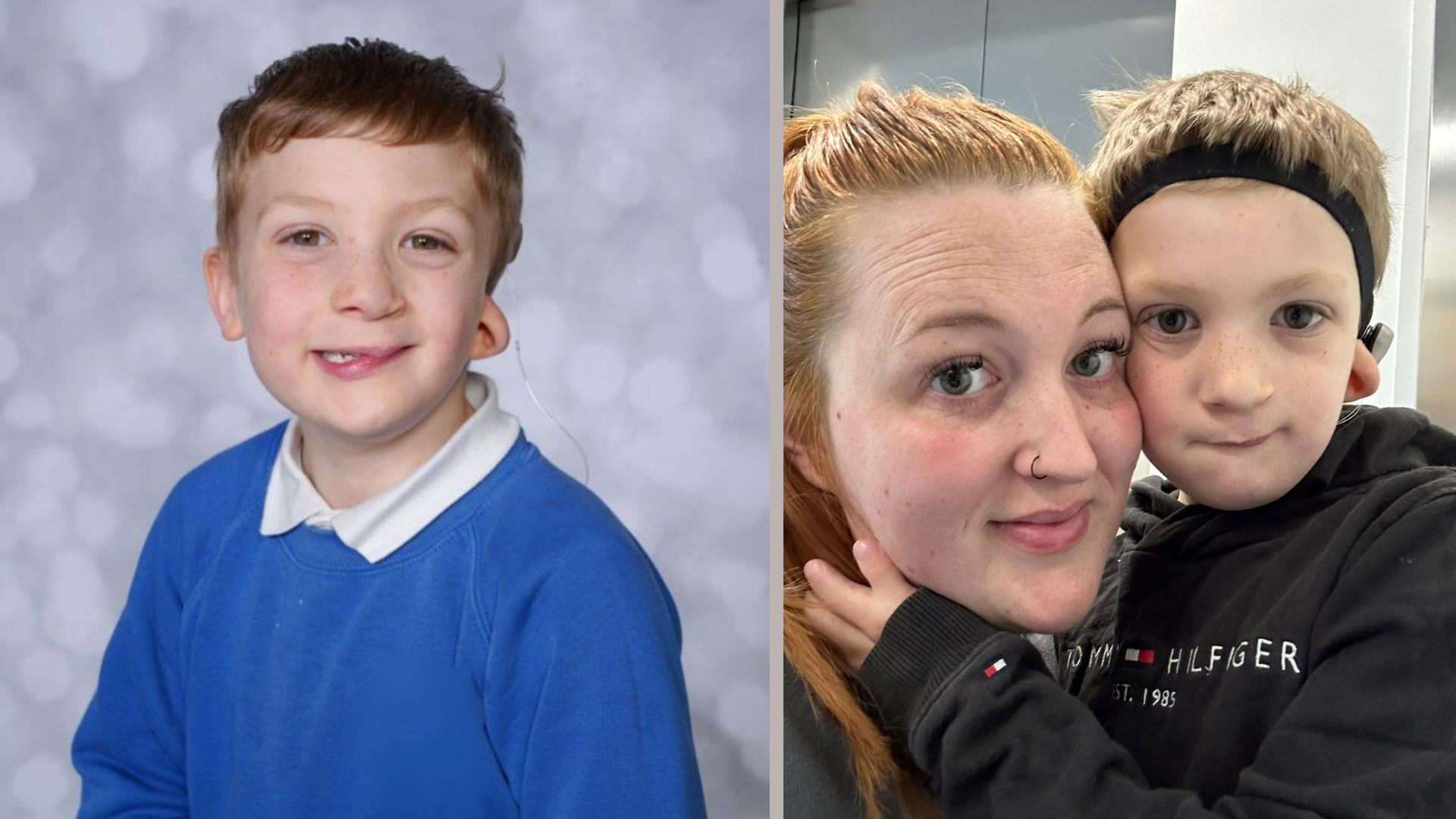Picture of Oscar, a child with Goldenhar syndrome at school, and his mum Kaitlyn.
