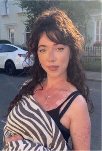 Den looking at the camera in a zebra print top