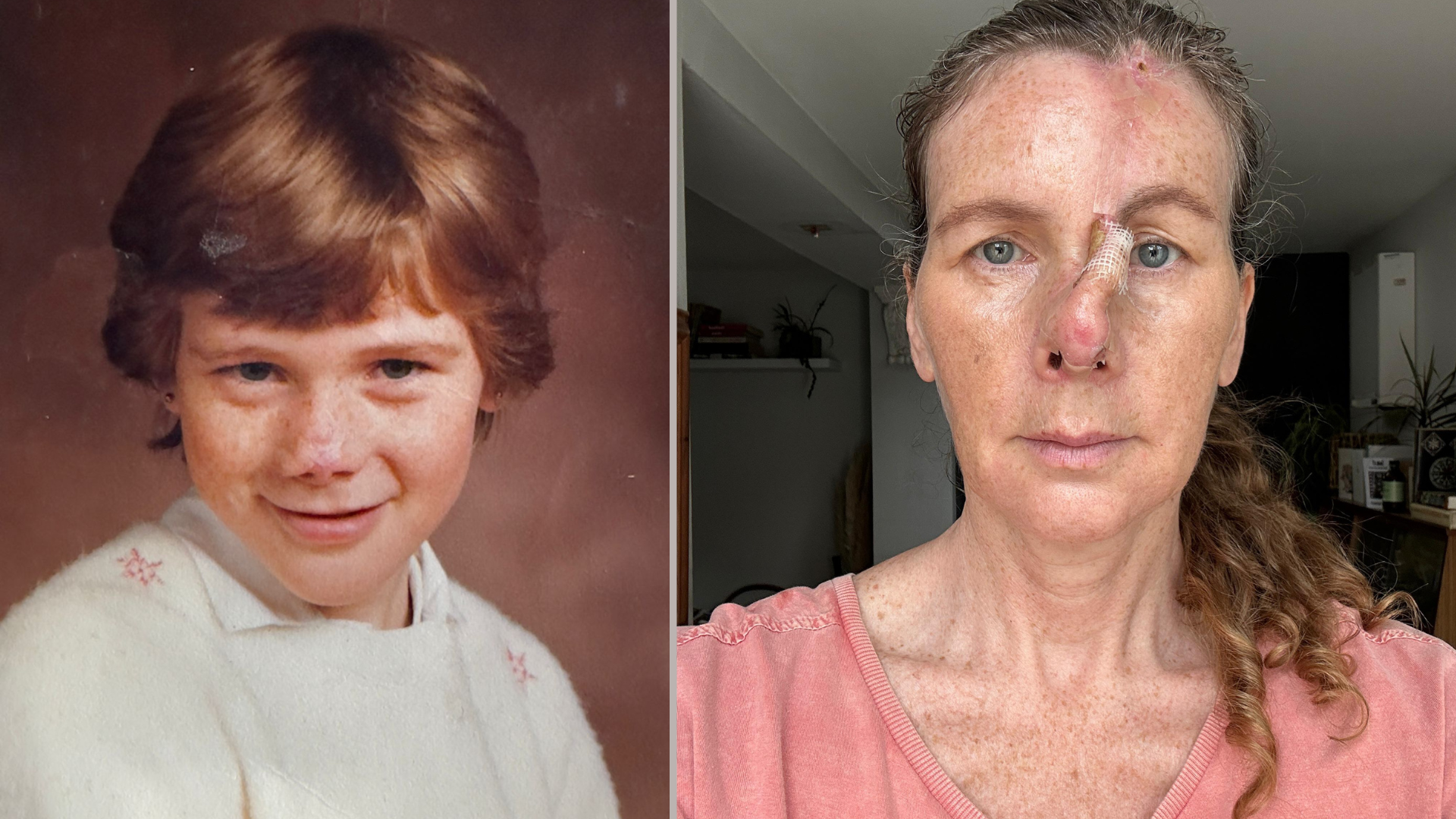 In between surgeries and during her recovery, Sarah has been reading stories from others with visible differences from Changing Faces.