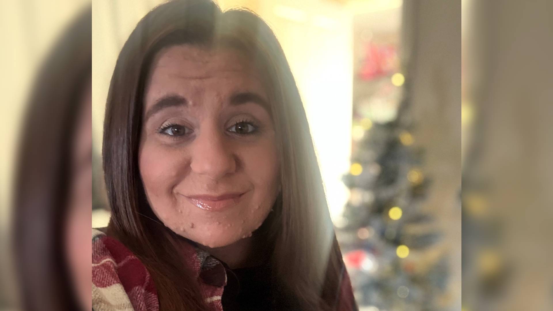 Ashleigh has the condition NF1. She has long dark hair and brown eyes. She smiles at the camera. A Christmas tree is behind her.