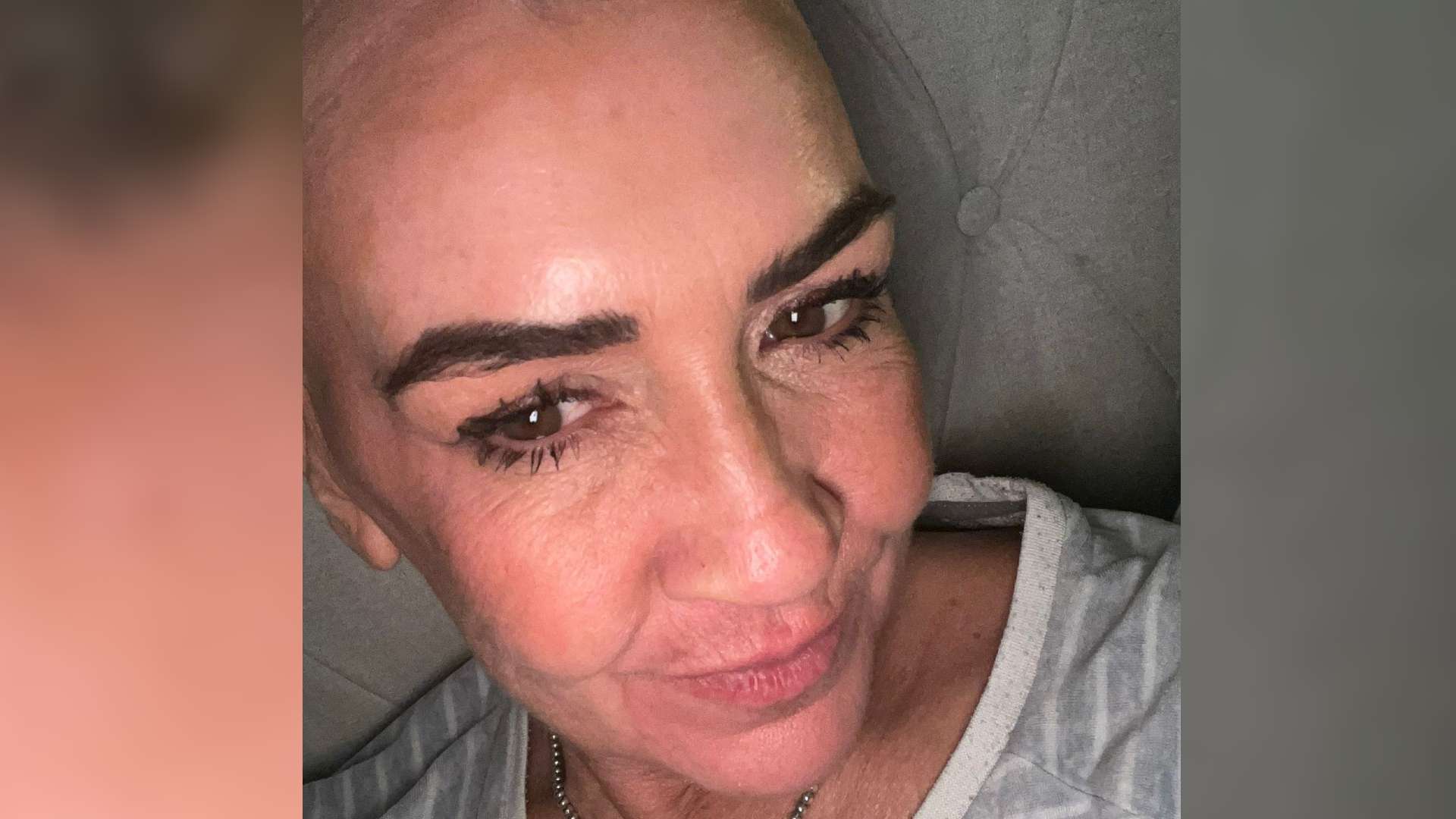 A selfie of Tracey. She has alopecia areata.