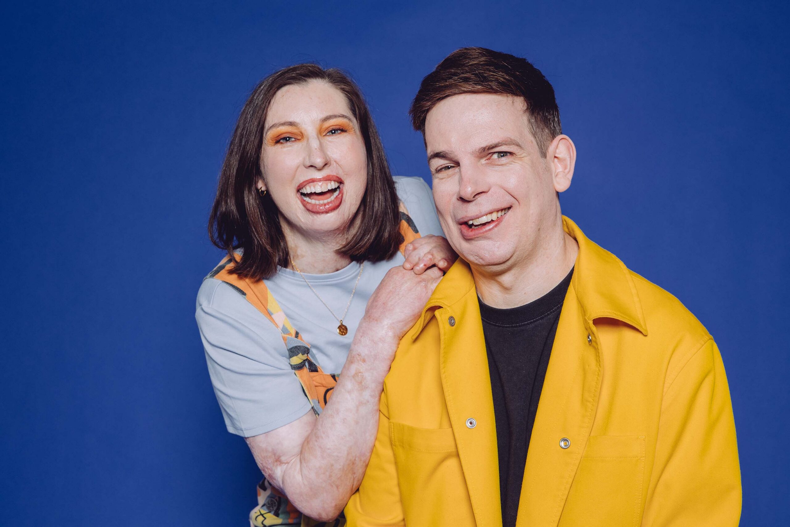 Two people with visible differences smiling at the camera