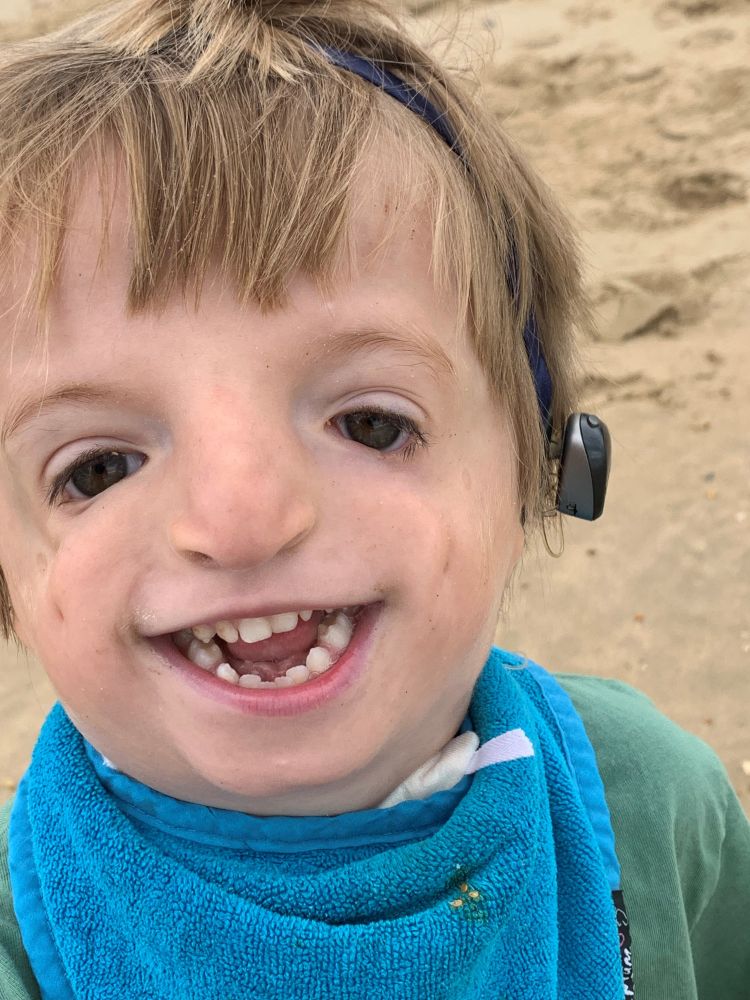 A young boy stood in the beach smiling at the camera. He is wearing a hearing aid and has a visible difference