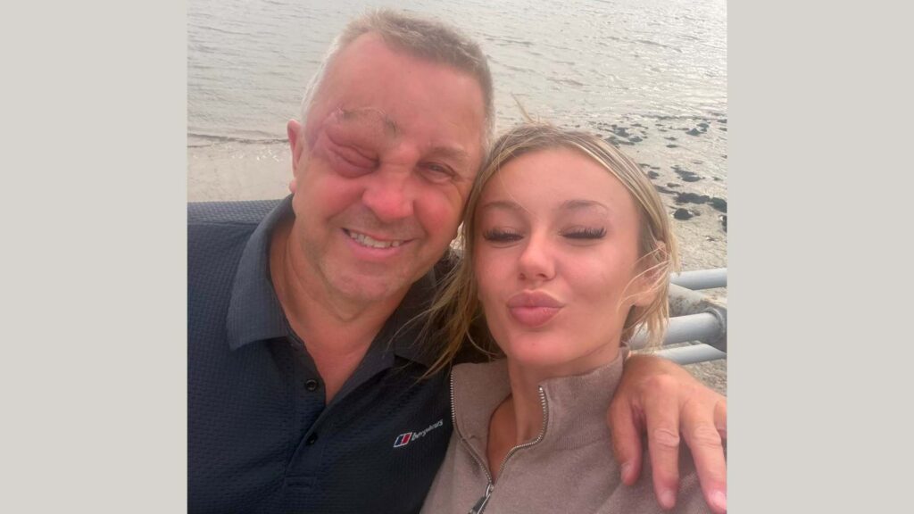 Phil, a white man in his fifties living with NF1, stands in front of a beach with his daughter, a blonde girl in her twenties
