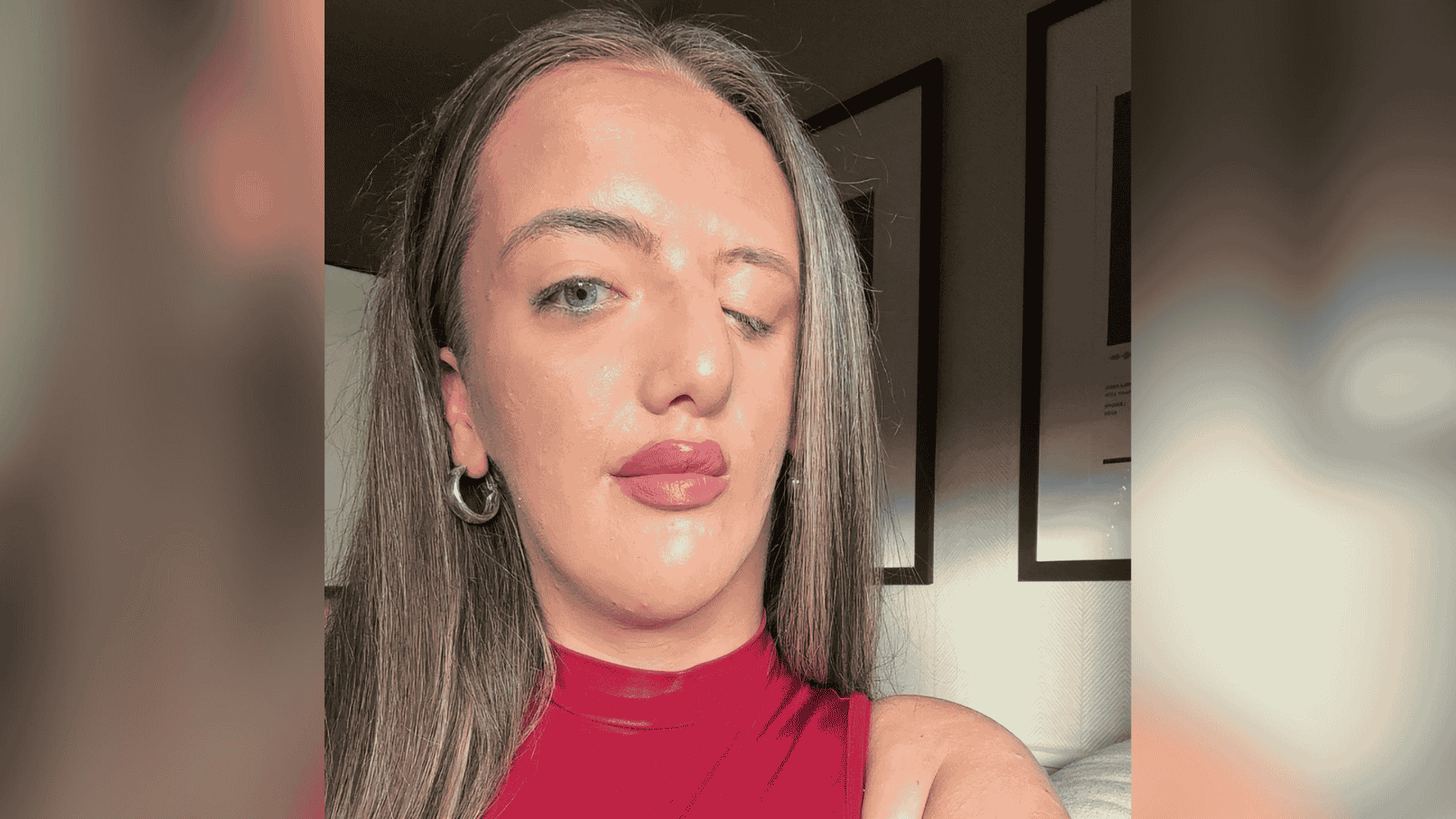 Lola is a teenage girl with goldenhar syndrome, resulting in a facial difference. She has long blonde hair and takes a selfie